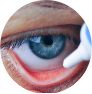 Closeup applying dry eye gel in lower eye lid