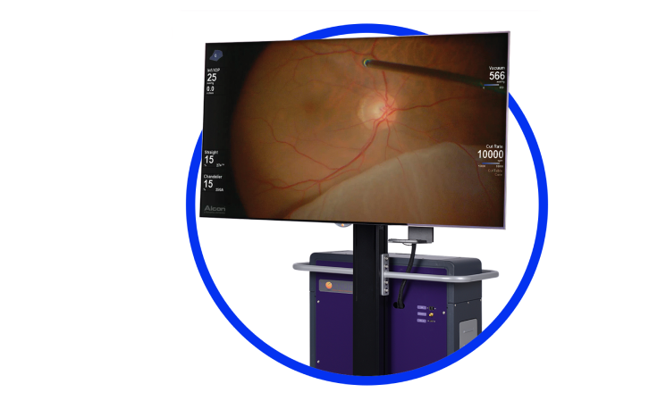 NGENUITY 3D Visualization System