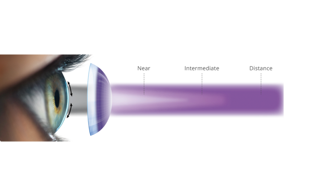 Smooth Progression of Power Gradients for Clear, Uninterrupted Vision From Near, to Intermediate, to Distance