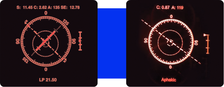 Real-time streaming information in your ocular with VerifEye Technology