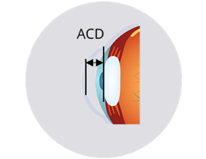 A cross-sectional illustration of an eye showing the anterior chamber depth (ACD) measurement, indicated by a double-headed arrow between the cornea and lens.