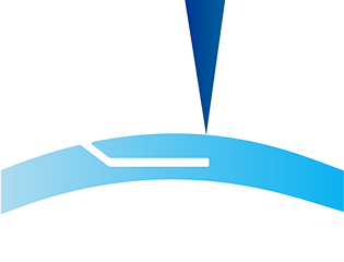 Illustration of a laser creating a pocket within the cornea.