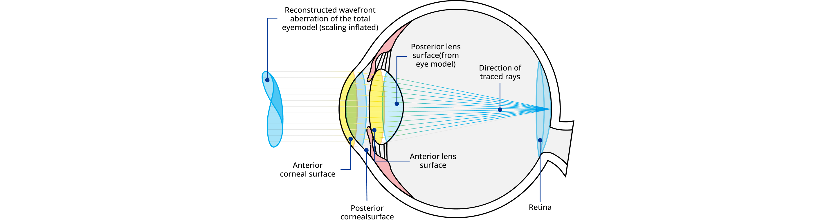 Diagram of the human eye showing wavefront aberration and light ray tracing. Labels identify the anterior and posterior corneal surfaces, anterior and posterior lens surfaces, direction of traced rays, and retina. A reconstructed wavefront shape is displayed outside the eye to illustrate total optical aberration.