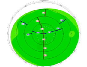 A corneal pachymetry map with green zones and numerical data, illustrating corneal thickness measurements across different regions for diagnostic analysis.