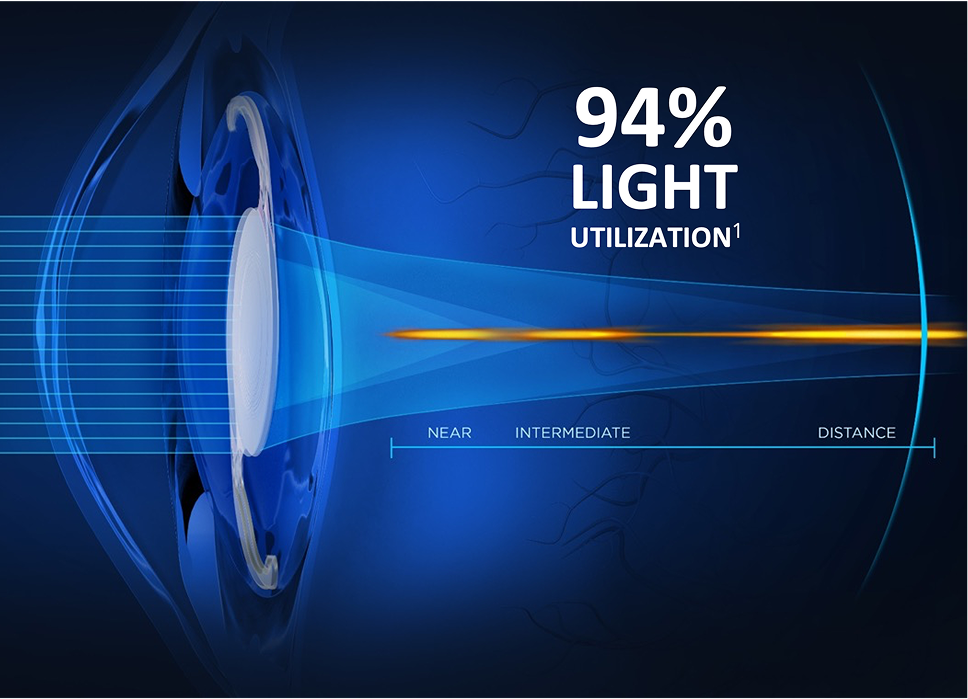 An illustration of an intraocular lens inside an eye, showing how light passes through it with 94% light utilization, improving vision from near to distance
