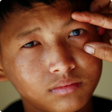 Male child receiving an eye exam