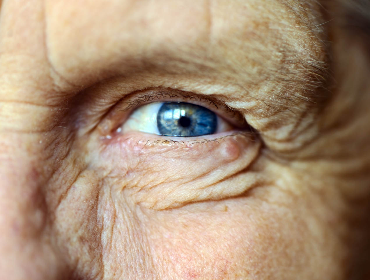 Close up on an older person's eye